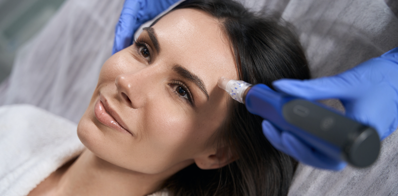 Skin Improvement With Microneedling