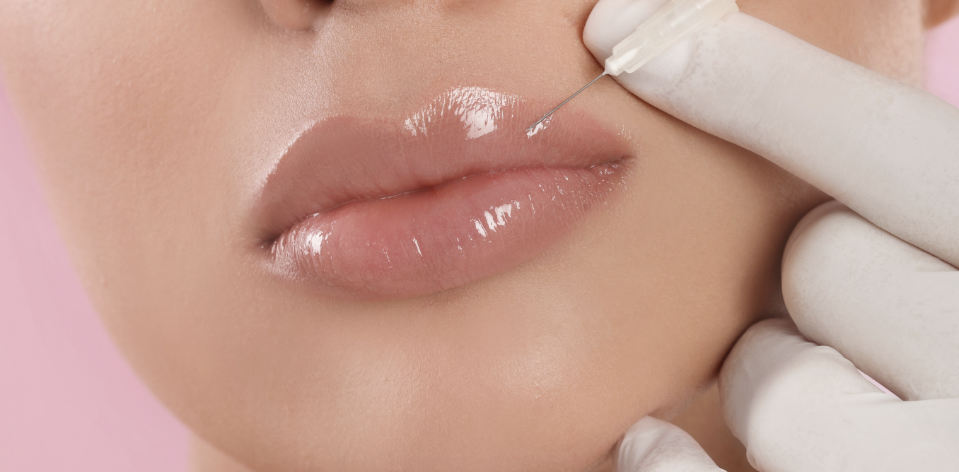 Longest Lasting Lip Fillers