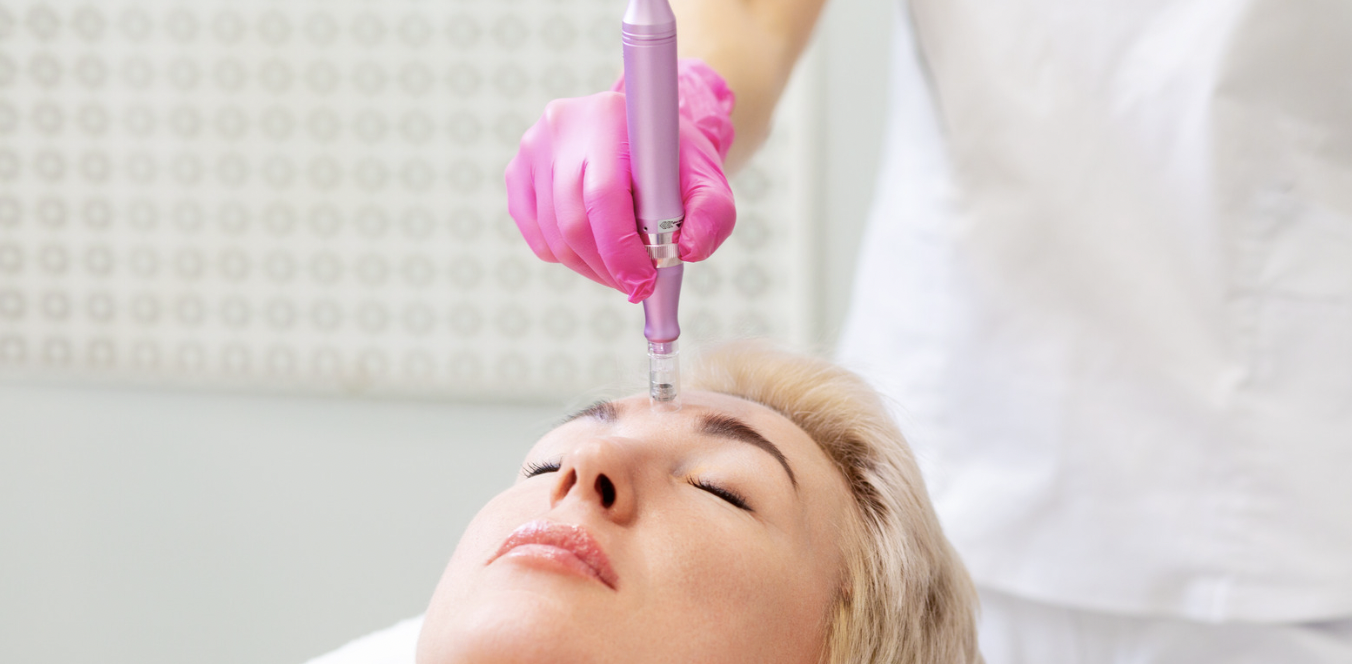 Microneedling and Skin Treatments in Bethesda