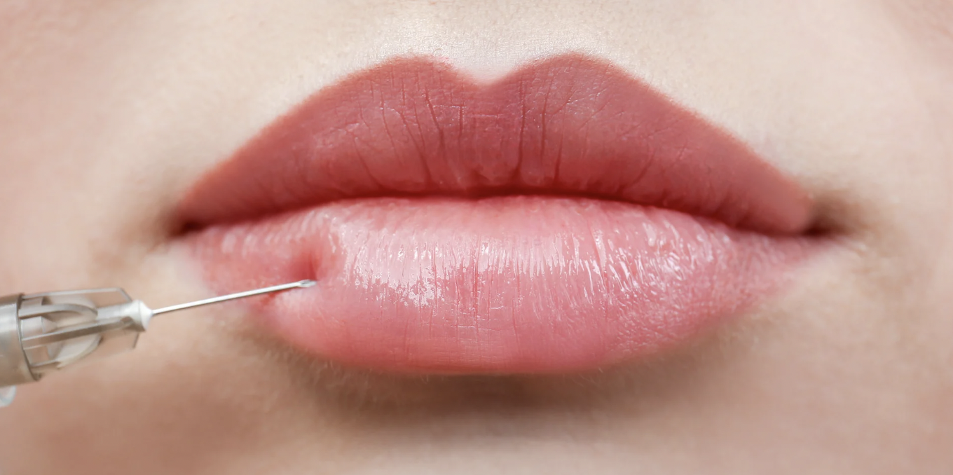 Same-Day Lip Filler Near North Bethesda Maryland