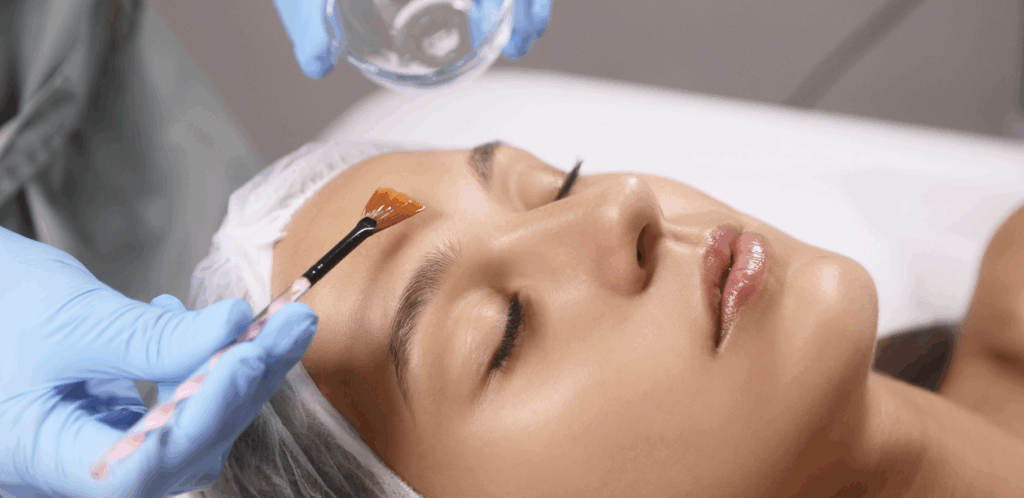 chemical peels for glowing skin near Silver Spring MD