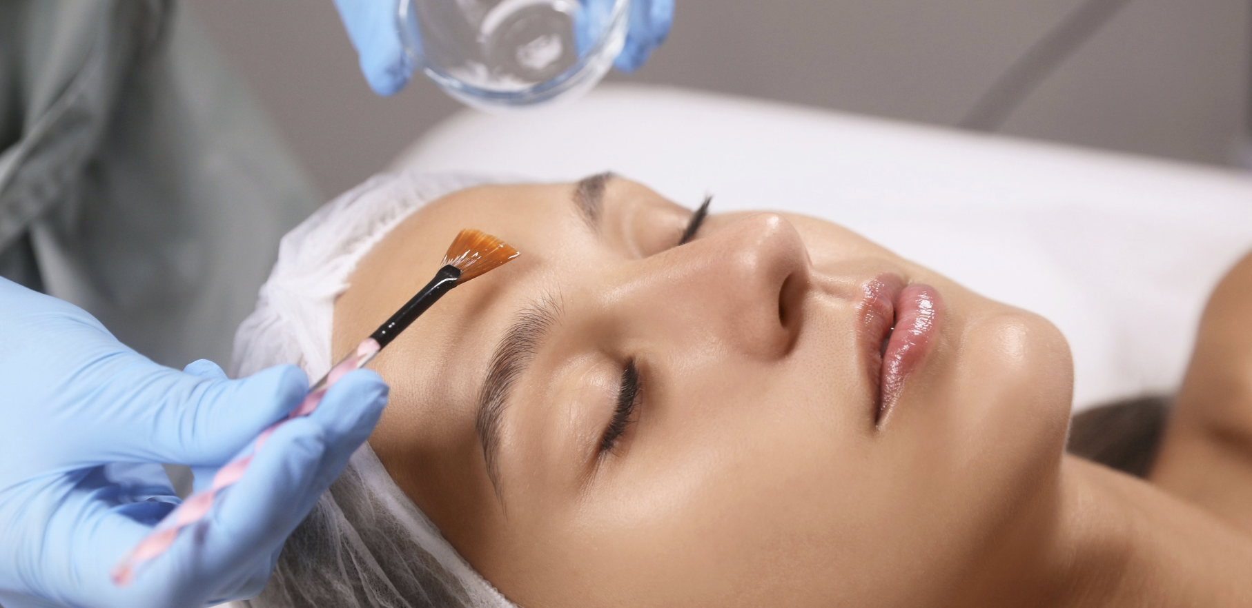 chemical peels for glowing skin near Silver Spring MD