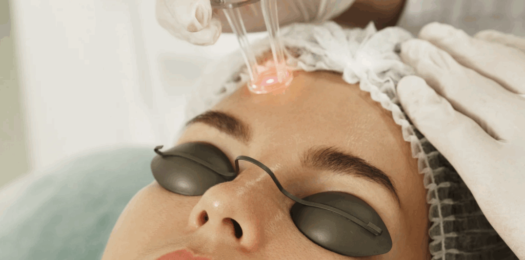 Package Pricing for Laser Skin Resurfacing and Free Consults in Gaithersburg Maryland