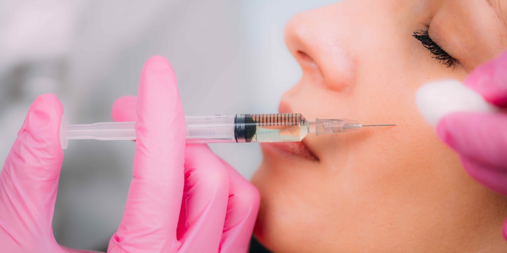 Cheek Filler and Facial Contouring in Rockville MD Natural Results