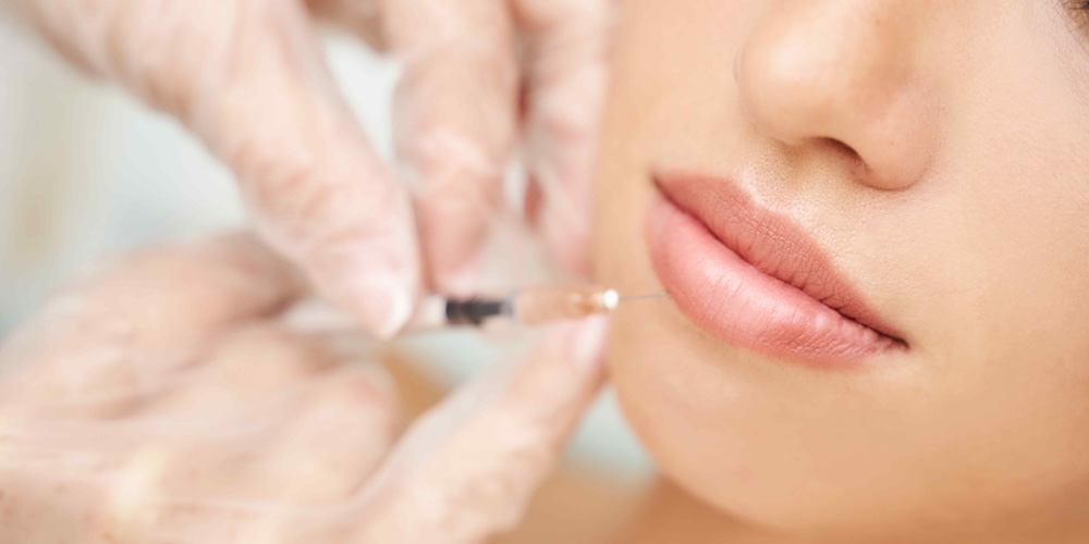 Lip Filler and Cheek Filler in Potomac MD