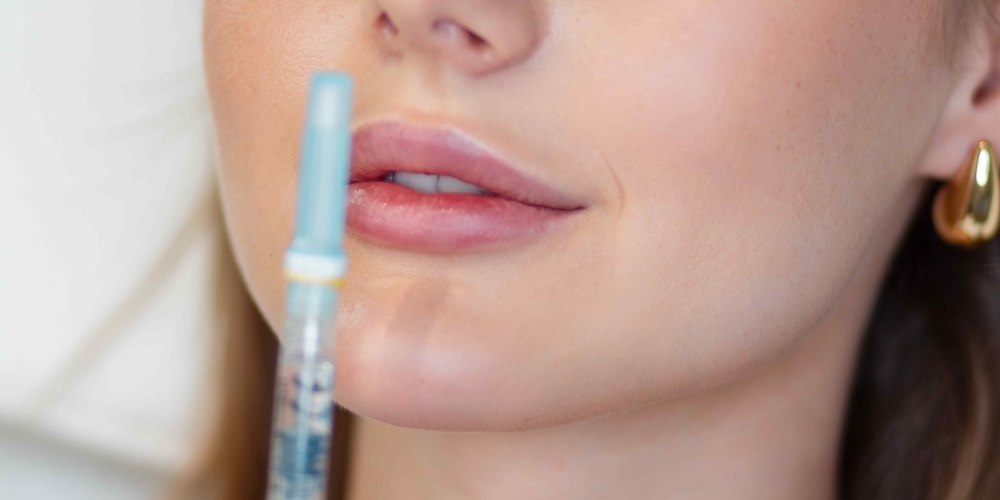 Lip Fillers and Facial Balancing Near Potomac MD