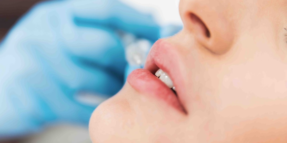 Lip Filler Near Bethesda Maryland