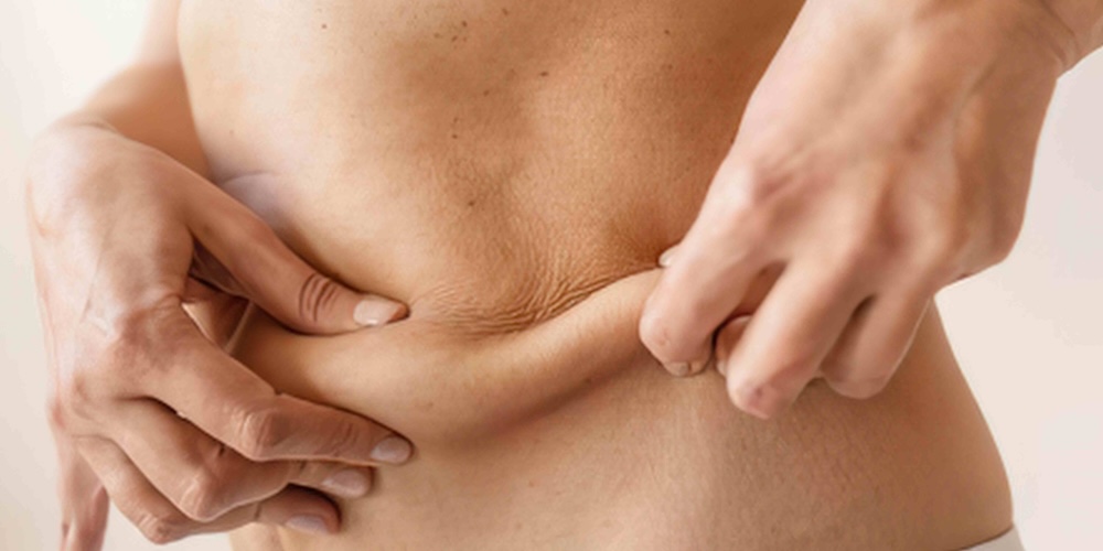 Skin Tightening and Body Sculpting Treatments in Bethesda MD