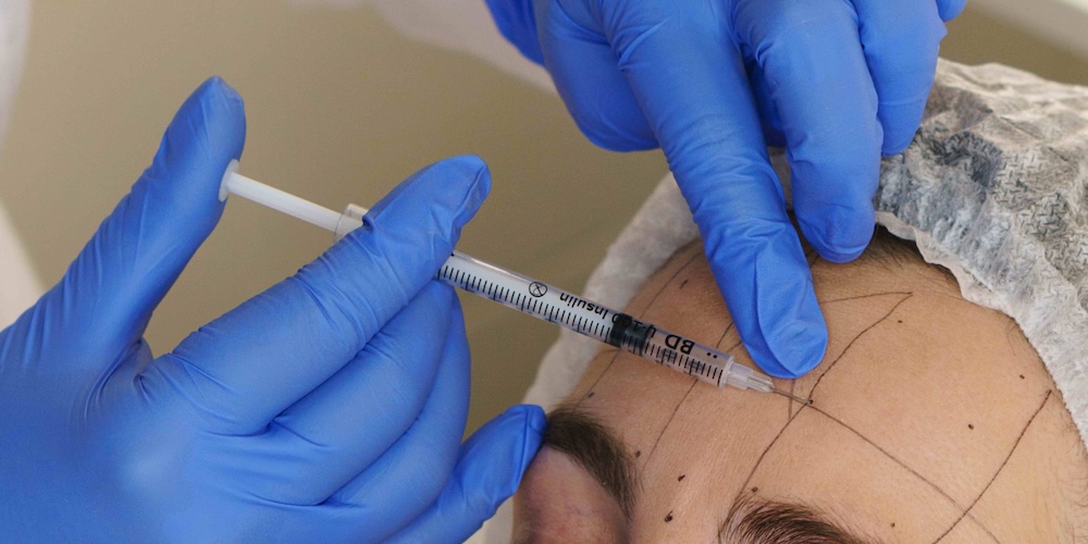 Same-Day Botox Appointments Near Gaithersburg MD