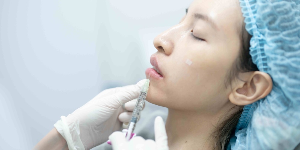 Hyaluronic Acid Lip Fillers Near Gaithersburg MD